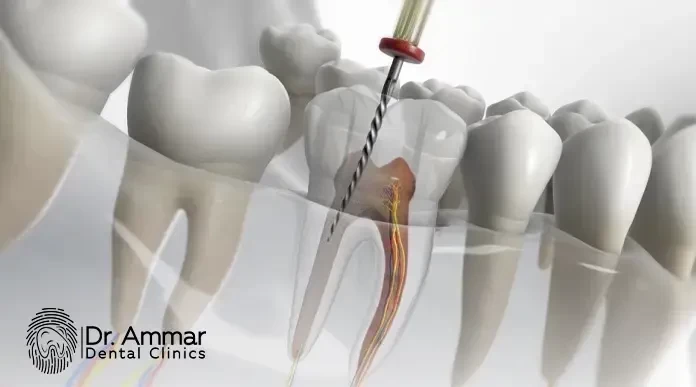افضل دكتور حشوات اسنان بجده