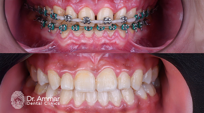 Best Orthodontist in Jeddah image