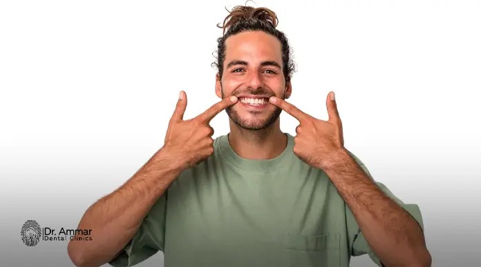 انواع الفينير للاسنان