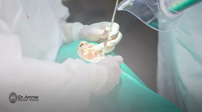 هل تنجح زراعة الاسنان لمريض السكر؟