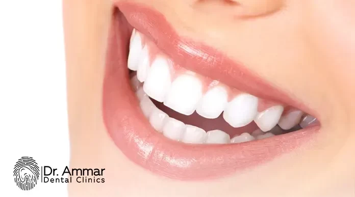 تنظيف وتلميع الاسنان