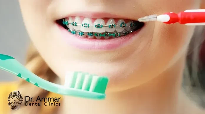 فرشاة تقويم الاسنان image