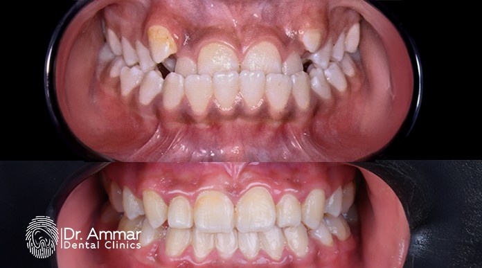 The best orthodontist in eastern Riyadh