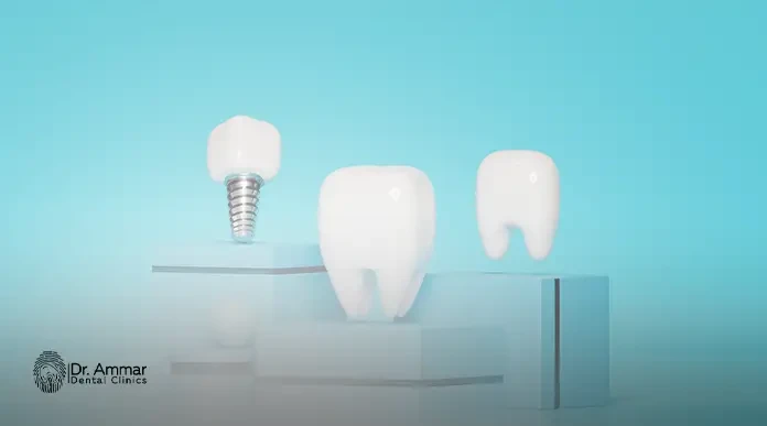 The best jaw implant center in Egypt