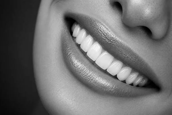 <p>ابتسامة هوليوود (ڤنيرز - عدسات)</p>