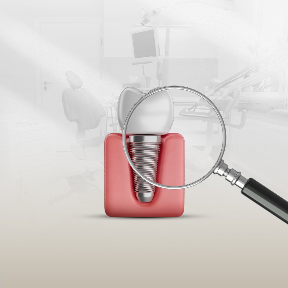 Dental implants image