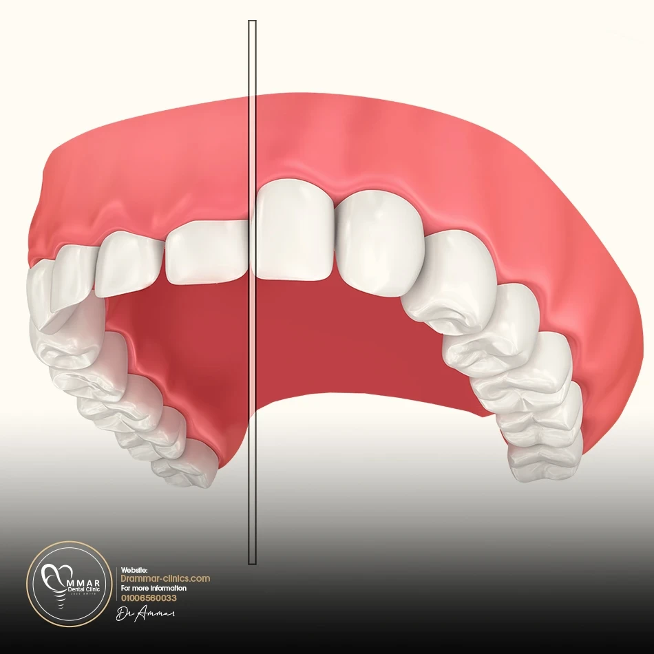Gum cutting image