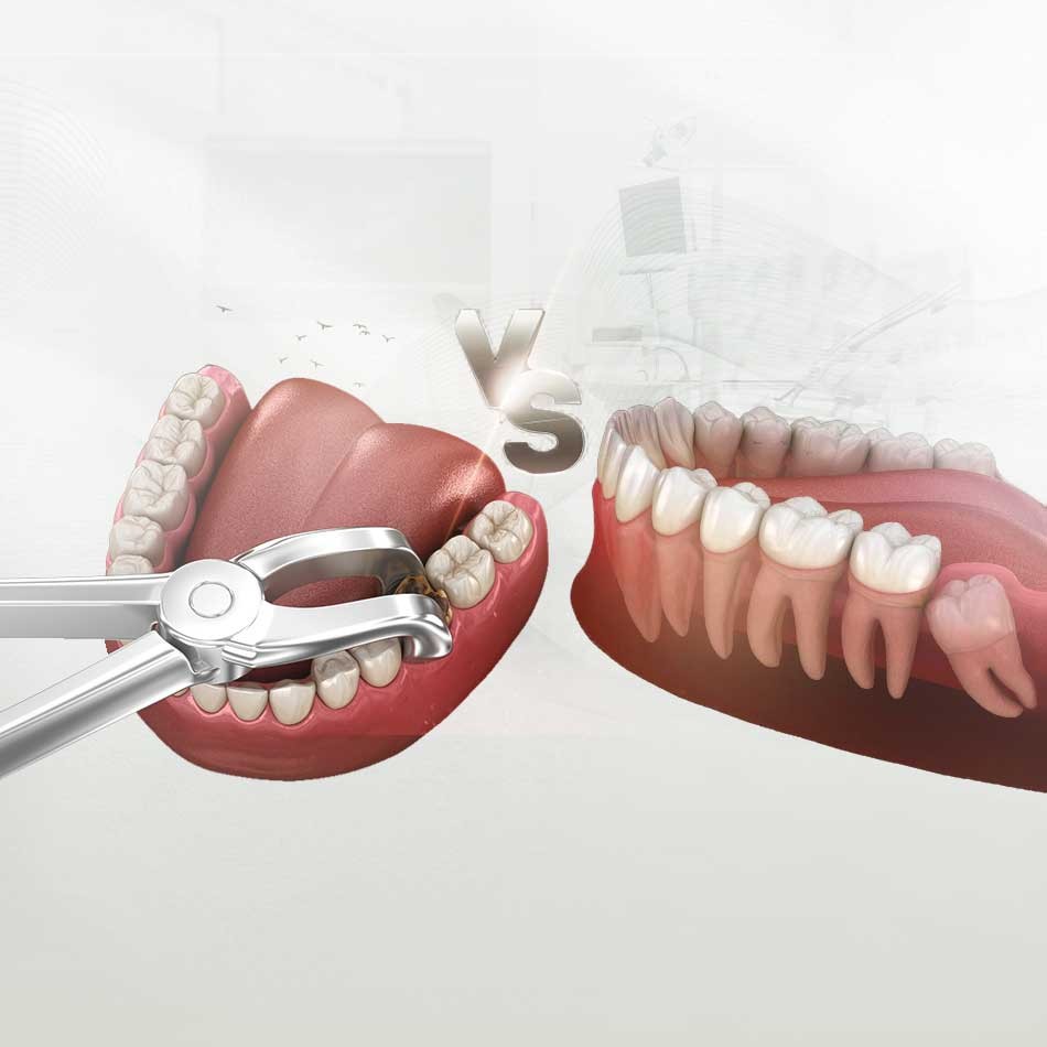 Dislocation and surgical dislocation image