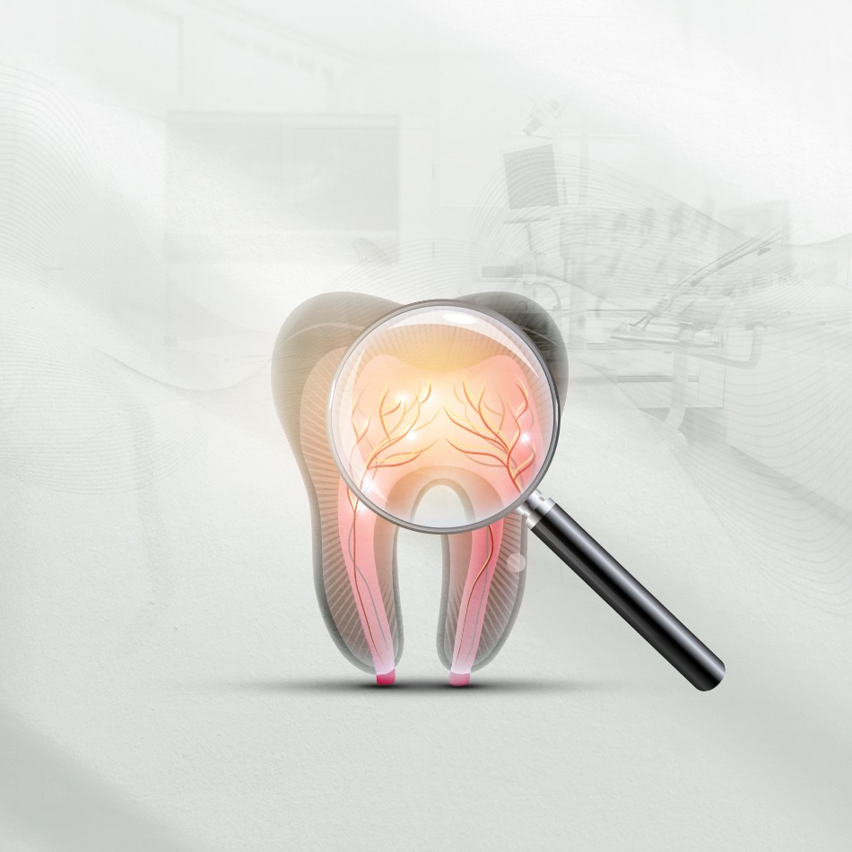 nerve filling image