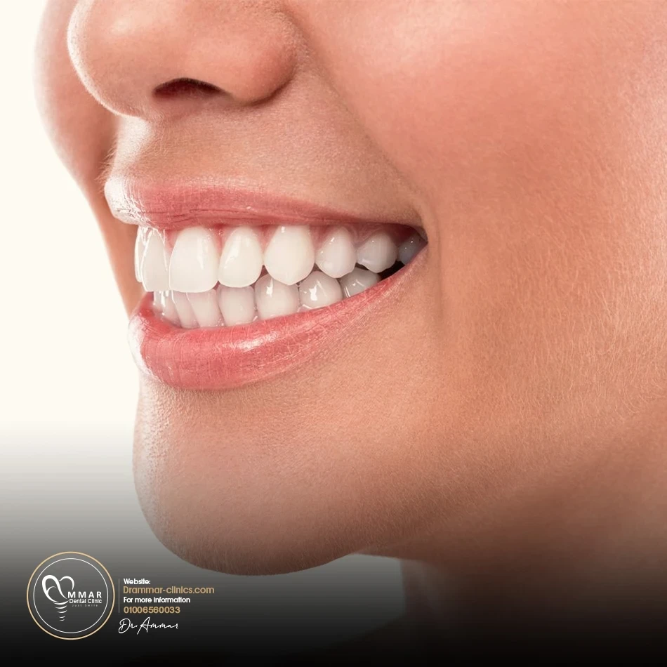 Full mouth rehabilitation image